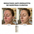 DERMAPURA