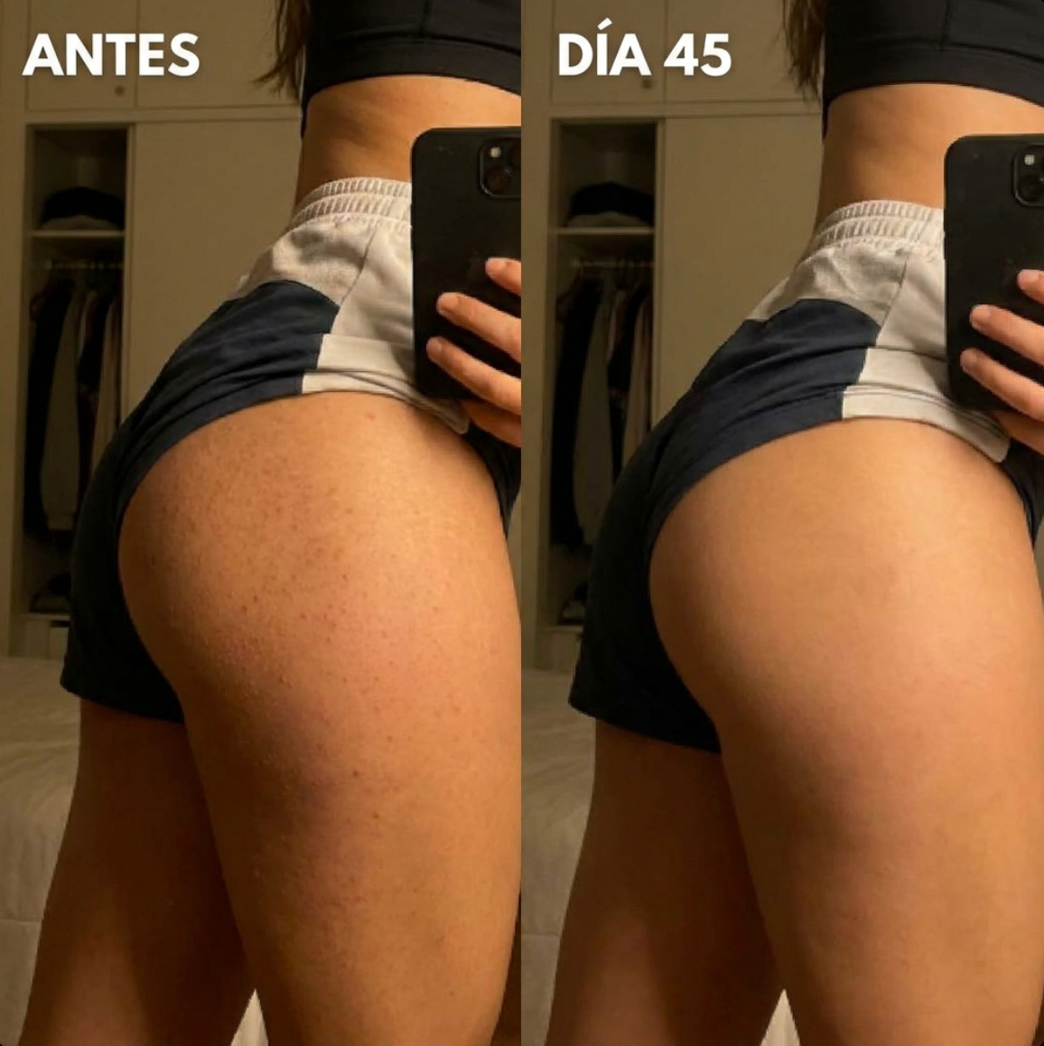 DERMAPURA