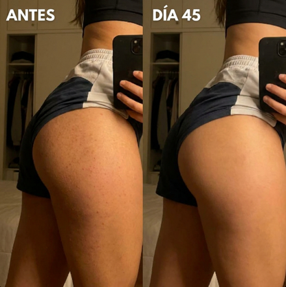 DERMAPURA