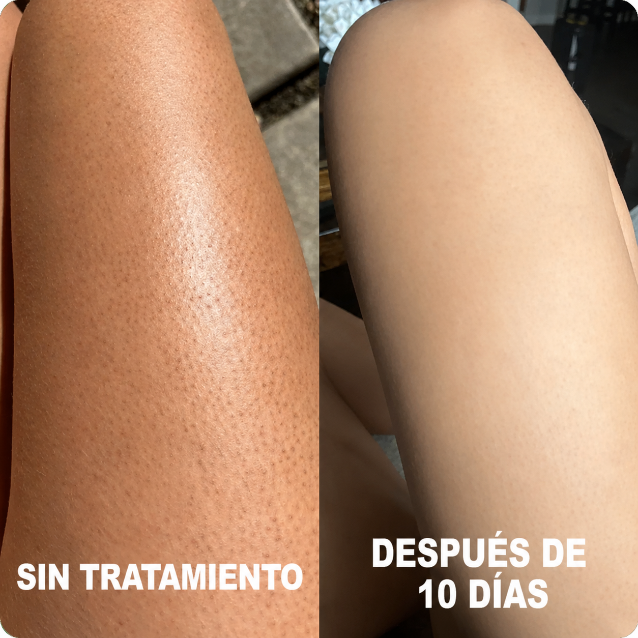 DERMAPURA