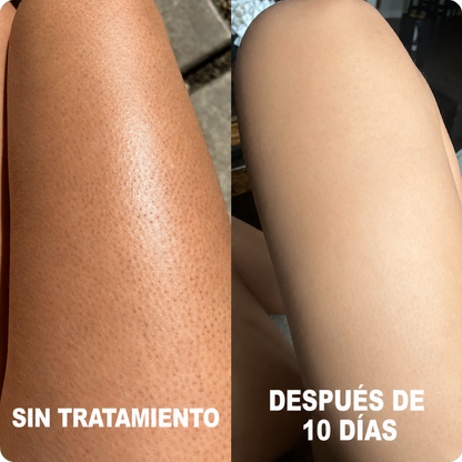 DERMAPURA
