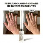 DERMAPURA