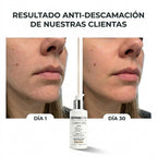 DERMAPURA