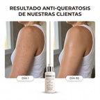 DERMAPURA