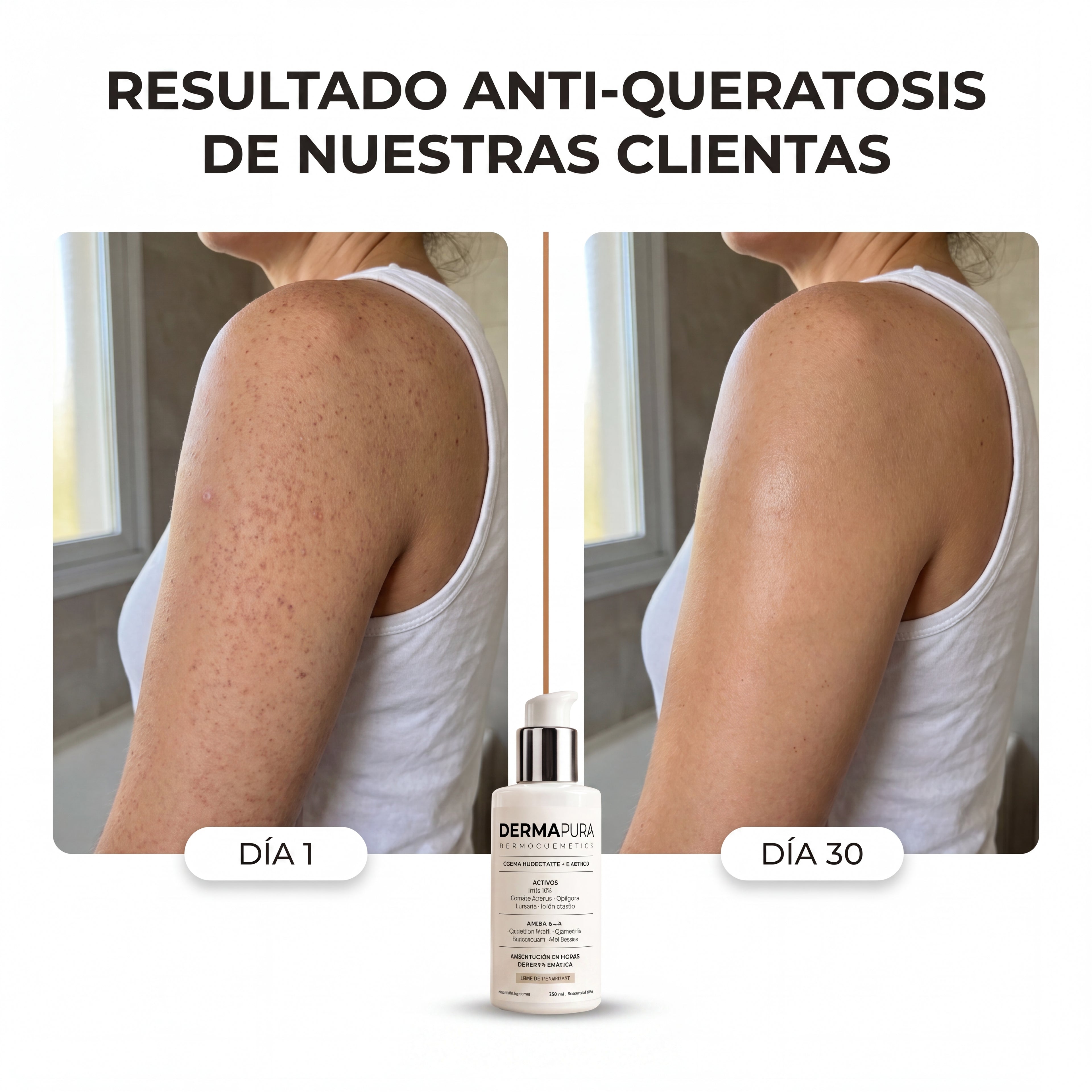 DERMAPURA